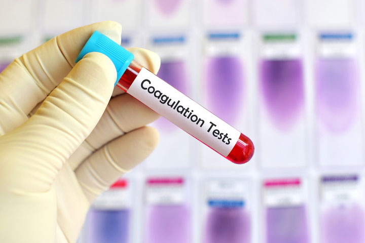 COAGULATION PROFILE